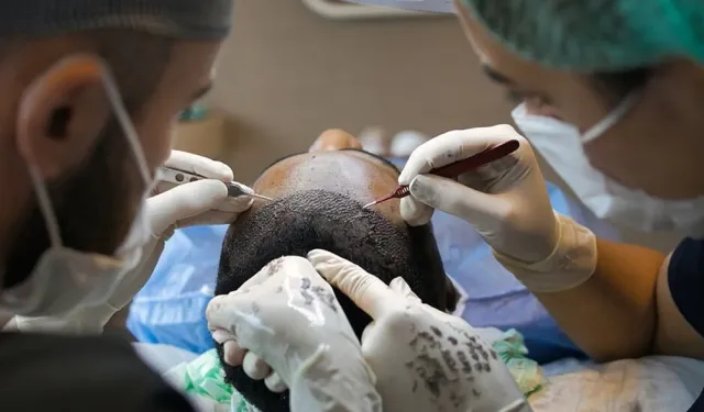 Sağlık Bakanlığı’ndan saç ekimi birimlerinde yeni dönem